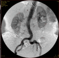 Angiographie