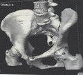 Computertomographie 3D (CT)